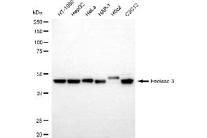 Western blotting analysis using enolase 3 antibody (ABIN7798451).