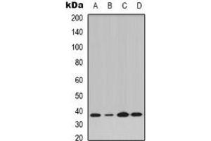 Western blot analysis of IKB alpha (pY42) expression in K562 (A), Jurkat IL1b-treated (B), Raw264. (NFKBIA anticorps  (N-Term, pTyr42))