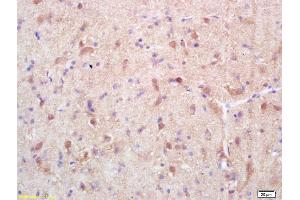 Formalin-fixed and paraffin embedded rat brain labeled with Rabbit Anti Exportin 1/CRM1 Polyclonal Antibody, Unconjugated (ABIN1714155) at 1:200 followed by conjugation to the secondary antibody and DAB staining
