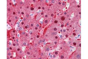 FAH antibody was used for immunohistochemistry at a concentration of 4-8 ug/ml. (FAH anticorps)