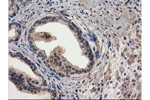 Image no. 14 for anti-Destrin (Actin Depolymerizing Factor) (DSTN) antibody (ABIN1497910) (Destrin anticorps)