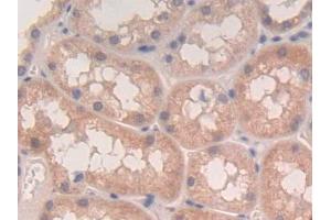 DAB staining on IHC-P; Samples: Human Kidney Tissue