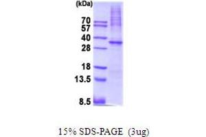 SDS-PAGE (SDS) image for Protein Kinase, AMP-Activated, alpha 1 Catalytic Subunit (PRKAA1) (AA 1-279) protein (His tag) (ABIN5854103)