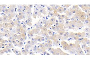 Detection of MCP2 in Bovine Liver Tissue using Polyclonal Antibody to Monocyte Chemotactic Protein 2 (MCP2) (CCL8 anticorps  (AA 1-99))