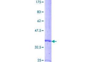 Image no. 1 for Pro-Platelet Basic Protein (Chemokine (C-X-C Motif) Ligand 7) (PPBP) (AA 1-128) protein (GST tag) (ABIN1315845)