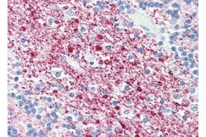 Human Brain, Cerebellum (formalin-fixed, paraffin-embedded) stained with SIRT2at 5 µg/ml followed by biotinylated goat anti-rabbit IgG secondary antibody, alkaline phosphatase-streptavidin and chromogen.