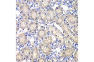 Immunohistochemistry of paraffin-embedded rat kidney using ACY1 antibody at dilution of 1:100 (x40 lens). (Aminoacylase 1 anticorps)