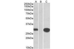 HEK293 lysate (10ug protein in RIPA buffer) overexpressing Human MID1IP1 with C-terminal MYC tag probed with AP22415PU-N (1 µg/ml) in Lane A and probed with anti-MYC Tag (1/1000) in lane C. (m1ip1 anticorps  (Internal Region))