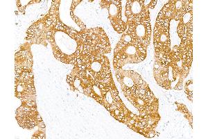 Immunohistochemistry (IHC) image for anti-Keratin 8 (KRT8) (C-Term) antibody (ABIN7795706)