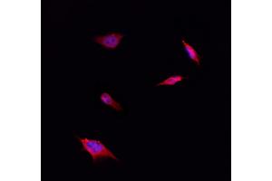 ABIN6261450 and ABIN6266845 staining Hela by IF/ICC. (EFNA4 anticorps  (Internal Region))