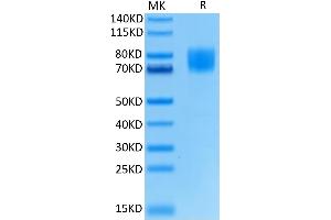 Biotinylated Human FGFR1 alpha (IIIc) on Tris-Bis PAGE under reduced condition.