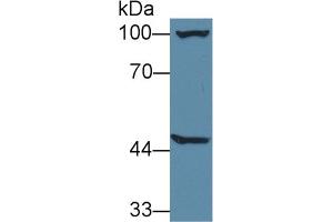 Western Blot; Sample: Mouse Liver lysate; Primary Ab: 1µg/ml Rabbit Anti-Mouse AGXT2 Antibody Second Ab: 0.