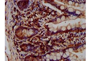 IHC image of ABIN7175328 diluted at 1:200 and staining in paraffin-embedded human small intestine tissue performed on a Leica BondTM system.