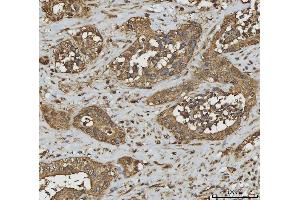 IHC analysis of Annexin A10/ANXA10 using anti-Annexin A10/ANXA10 antibody (ABIN7601853). (Annexin a10 anticorps  (AA 49-324))