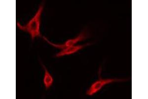 ABIN6274565 staining Hela cells by IF/ICC. (14-3-3 gamma anticorps  (Internal Region))