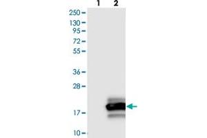 Western blot analysis of Lane 1: Negative control (vector only transfected HEK293T lysate), Lane 2: Over-expression Lysate (Co-expressed with a C-terminal myc-DDK tag (~3. (Otoraplin anticorps)