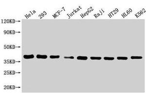 Western Blot Positive WB detected in: Hela whole cell lysate, HEK293 whole cell lysate, MCF-7 whole cell lysate, Jurkat whole cell lysate, HepG2 whole cell lysate, Raji whole cell lysate, HT29 whole cell lysate, HL60 whole cell lysate, K562 whole cell lysate All lanes: HTRA2 antibody at 1:2000 Secondary Goat polyclonal to rabbit IgG at 1/50000 dilution Predicted band size: 39, 49, 47, 40 kDa Observed band size: 39 kDa