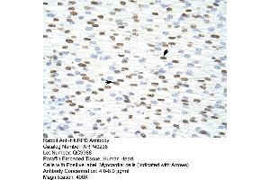 Rabbit Anti-HNRPD Antibody  Paraffin Embedded Tissue: Human Heart Cellular Data: Myocardial cells Antibody Concentration: 4.
