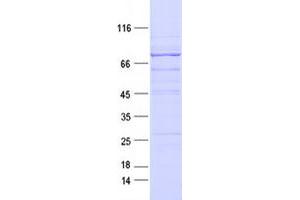 Validation with Western Blot