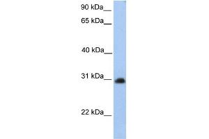 WB Suggested Anti-CHST14 Antibody Titration:  0. (CHST14 anticorps  (Middle Region))