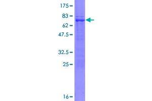 Image no. 1 for Tripartite Motif Containing 10 (TRIM10) (AA 1-395) protein (GST tag) (ABIN1323597)