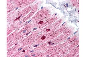 Anti-ANP32A antibody IHC of human heart. (PHAP1 anticorps  (C-Term))