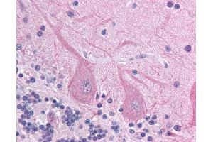 Anti-ACCN4 antibody IHC of human brain, cerebellum.