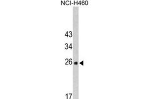 Western Blotting (WB) image for anti-FK506 Binding Protein 14, 22 KDa (FKBP14) antibody (ABIN3002691)
