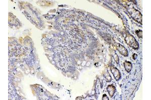 IHC analysis of ETV6/Tel using anti-ETV6/Tel antibody .