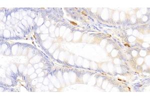 Detection of TPS in Canine Colon Tissue using Polyclonal Antibody to Tryptase (TPS)