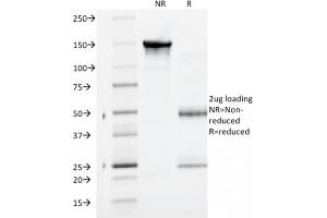 SDS-PAGE Analysis Purified Catenin, gamma Mouse Monoclonal Antibody (CTNG/1664).