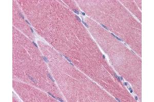 IHC testing of FFPE human skeletal muscle tissue with CREB3L1 antibody at 3. (CREB3L1 anticorps)