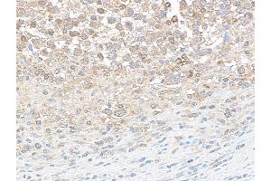anti-DEAD (Asp-Glu-Ala-Asp) Box Polypeptide 3, X-Linked (DDX3X) (AA 1-50) antibody