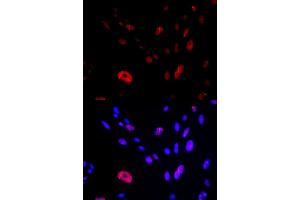 Immunofluorescence analysis of U2OS cells using HUS1 antibody (ABIN5973136). (HUS1 anticorps)