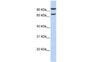 FAM38B antibody used at 1 ug/ml to detect target protein.