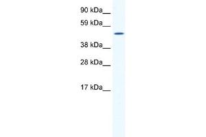 SP1 antibody (20R-1138) used at 0. (SP1 anticorps  (Middle Region))