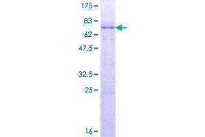 Image no. 1 for LIM Homeobox 4 (LHX4) (AA 1-390) protein (GST tag) (ABIN1309380)