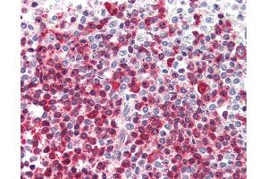 Anti-DKC1 antibody IHC of human spleen. (DKC1 anticorps  (AA 446-460))