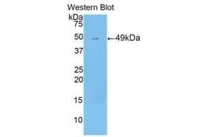 Detection of Recombinant PXR, Mouse using Polyclonal Antibody to Pregnane X Receptor (PXR)