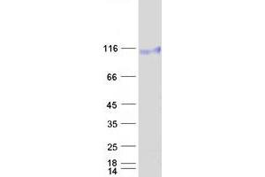 Validation with Western Blot