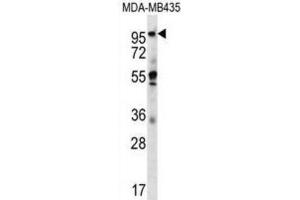 Western Blotting (WB) image for anti-Melanoma Inhibitory Activity Protein 2 (MIA2) antibody (ABIN2996927) (MIA2 anticorps)