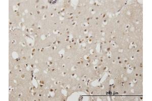 Immunoperoxidase of monoclonal antibody to EMX2 on formalin-fixed paraffin-embedded human cerebral cortex. (EMX2 anticorps  (AA 103-200))