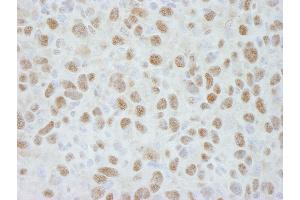 Immunohistochemistry (IHC) image for anti-Damage Specific DNA Binding Protein 1 (DDB1) (C-Term) antibody (ABIN7448511)