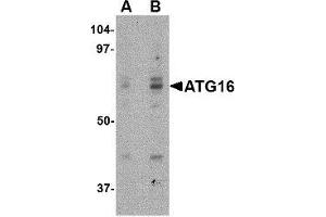 Western blot analysis of ATG16 in HeLa cell lysate with ATG16 antibody at (A) 0. (ATG16L1 anticorps  (Center))