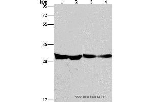 Western blot analysis of Human endometrial carcinoma and colon cancer tissue, mouse heart tissue and PC3 cell, using DECR1 Polyclonal Antibody at dilution of 1:300