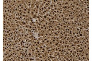 ABIN6261479 and ABIN6279420 at 1/100 staining Rat liver tissue by IHC-P.