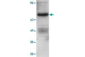 Western blot using PRKCB polyclonal antibody  shows detection of PRKCB in ~25 ug of U251 whole cell lysate (glioma derived). (PKC beta anticorps  (Internal Region))