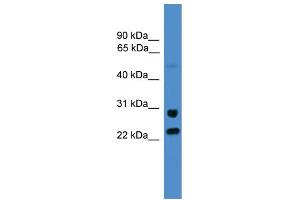 WB Suggested Anti-KIAA0152  Antibody Titration: 0.