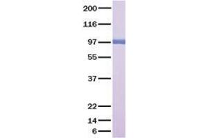 Validation with Western Blot