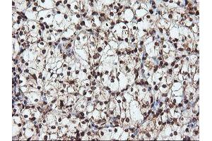 Image no. 1 for anti-SAM Domain and HD Domain 1 (SAMHD1) antibody (ABIN1500798)